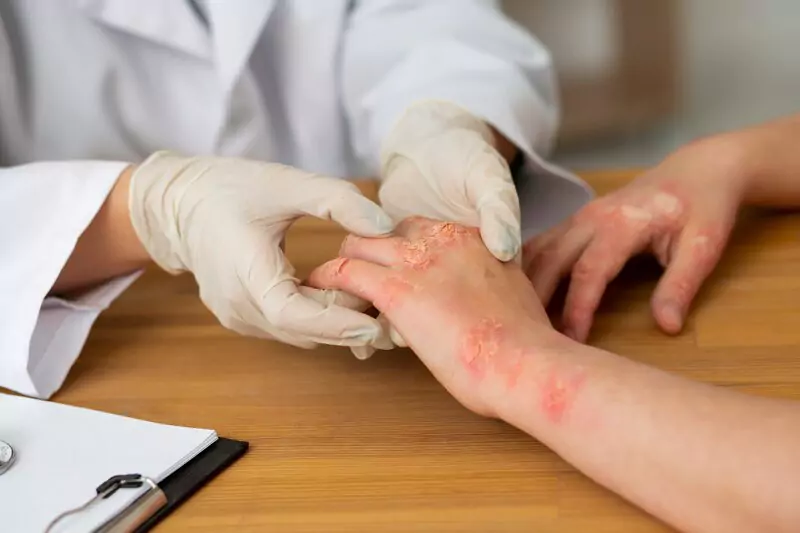 homeopathy doctor for psoriasis in hanamkonda